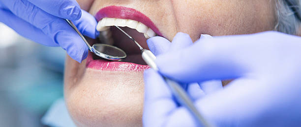 Best Emergency Gum Treatment in Stone Ridge, VA